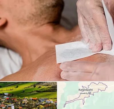 اپیلاسیون آقایان در کلاردشت