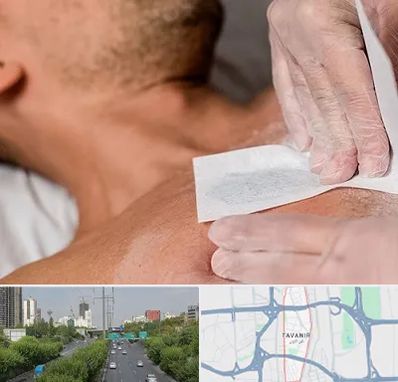 اپیلاسیون آقایان در توانیر