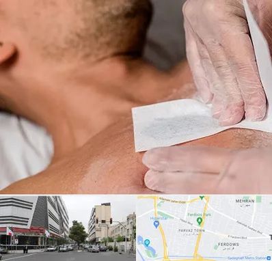 اپیلاسیون آقایان در بلوار فردوس 