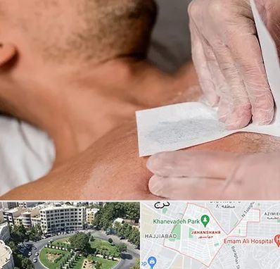 اپیلاسیون آقایان در جهانشهر کرج 