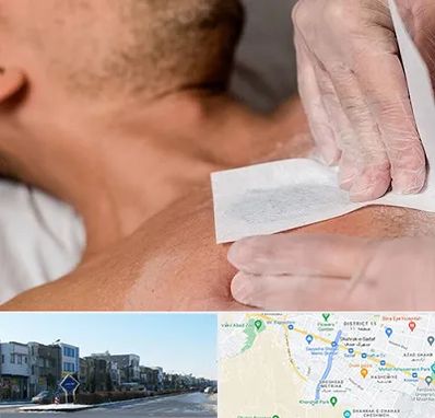 اپیلاسیون آقایان در شریعتی مشهد