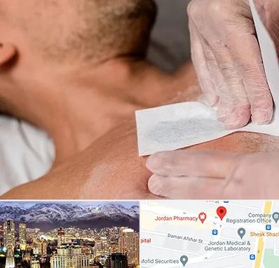 اپیلاسیون آقایان در جردن 
