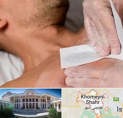 اپیلاسیون آقایان در خمینی شهر