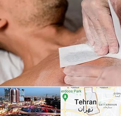 اپیلاسیون آقایان در صادقیه 