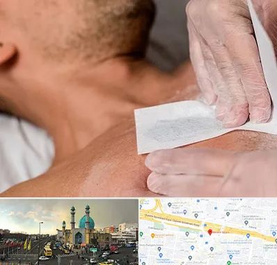 اپیلاسیون آقایان در رسالت 