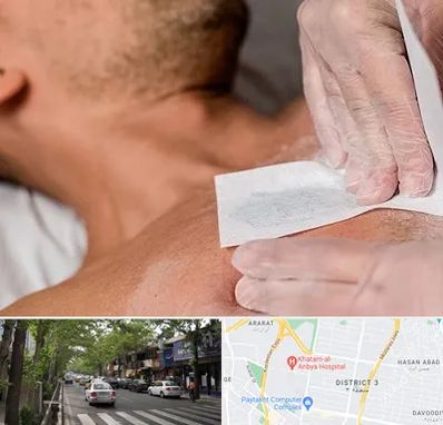 اپیلاسیون آقایان در ظفر 