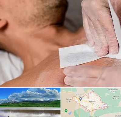 اپیلاسیون آقایان در مرند