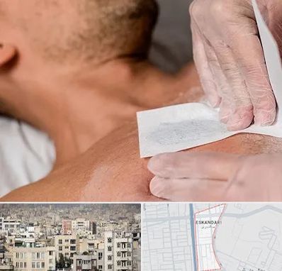 اپیلاسیون آقایان در اسکندری