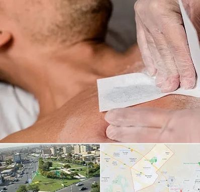 اپیلاسیون آقایان در کمال شهر کرج