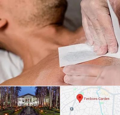 اپیلاسیون آقایان در باغ فردوس