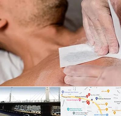 اپیلاسیون آقایان در پارک وی 