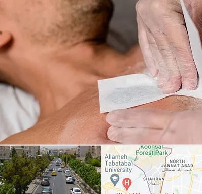 اپیلاسیون آقایان در شهران 