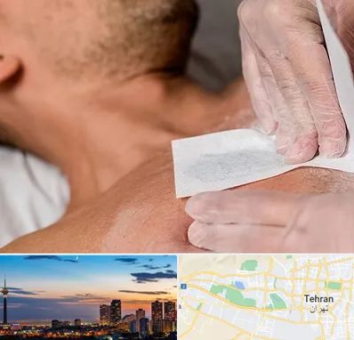 اپیلاسیون آقایان در غرب تهران 