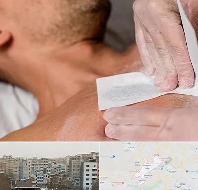 اپیلاسیون آقایان در محمد شهر کرج