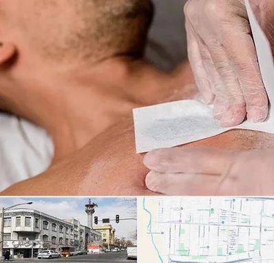 اپیلاسیون آقایان در 17شهریور