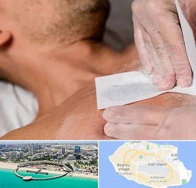 اپیلاسیون آقایان در کیش