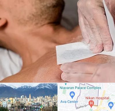 اپیلاسیون آقایان در آجودانیه 