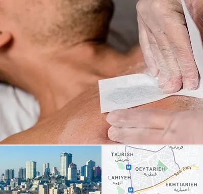 اپیلاسیون آقایان در قیطریه 