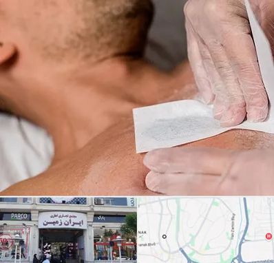 اپیلاسیون آقایان در ایران زمین