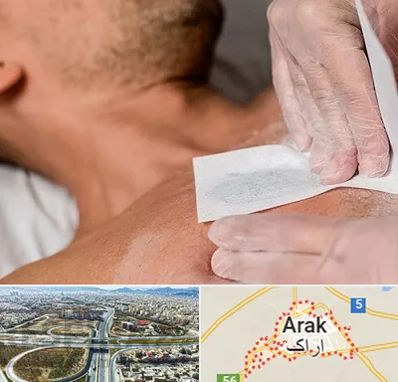 اپیلاسیون آقایان در اراک