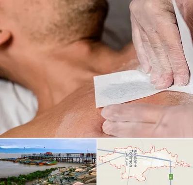 اپیلاسیون آقایان در بندر ترکمن
