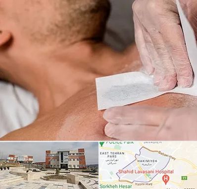 اپیلاسیون آقایان در حکیمیه 