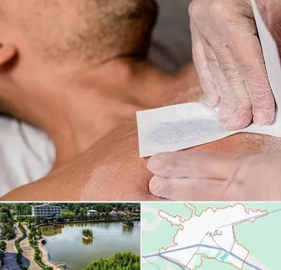 اپیلاسیون آقایان در لنگرود