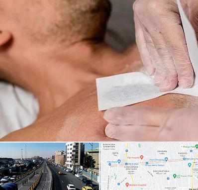 اپیلاسیون آقایان در پیروزی 