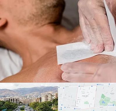 اپیلاسیون آقایان در خانی آباد