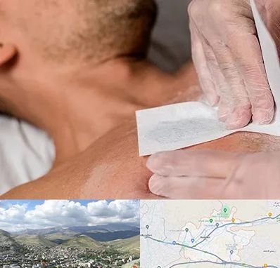 اپیلاسیون آقایان در رودهن