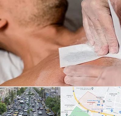 اپیلاسیون آقایان در گلشهر کرج