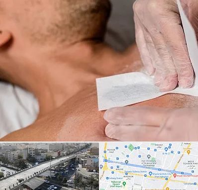 اپیلاسیون آقایان در فرجام