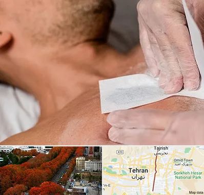 اپیلاسیون آقایان در ولیعصر 