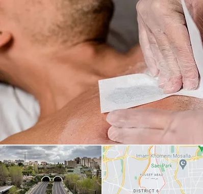 اپیلاسیون آقایان در یوسف آباد 