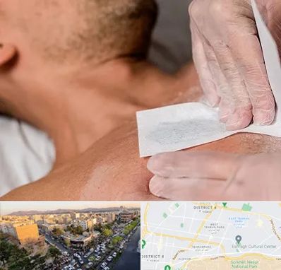 اپیلاسیون آقایان در تهرانپارس 