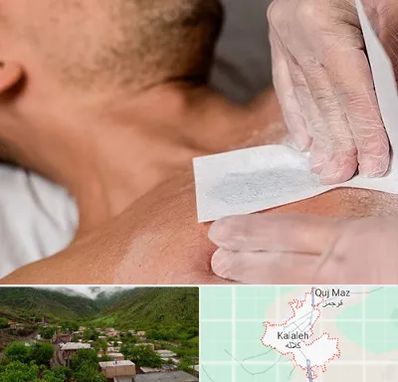 اپیلاسیون آقایان در کلاله