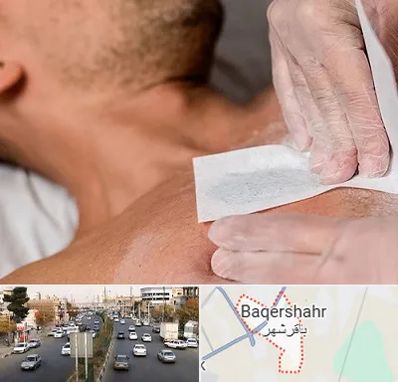 اپیلاسیون آقایان در باقرشهر