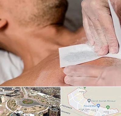 اپیلاسیون آقایان در پرند