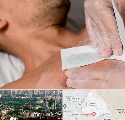 اپیلاسیون آقایان در عظیمیه کرج 