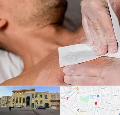 اپیلاسیون آقایان در زنبیل آباد قم