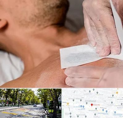 اپیلاسیون آقایان در میرداماد 