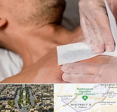 اپیلاسیون آقایان در نارمک 