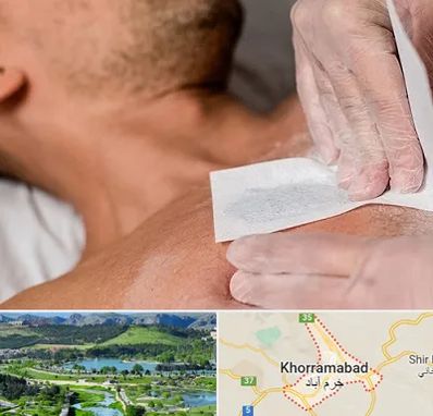 اپیلاسیون آقایان در خرم آباد