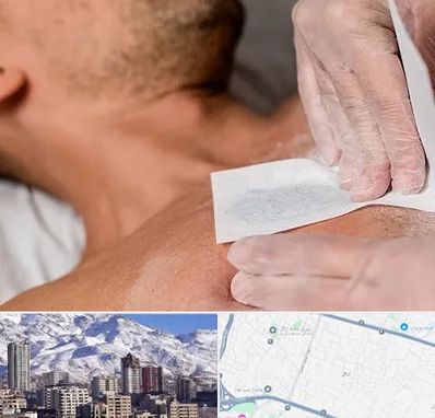 اپیلاسیون آقایان در ازگل