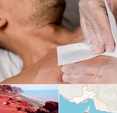 اپیلاسیون آقایان در هرمزگان