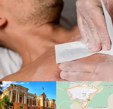 اپیلاسیون آقایان در خوی