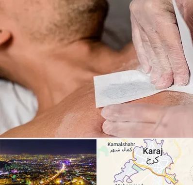 اپیلاسیون آقایان در کرج