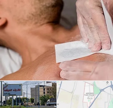 اپیلاسیون آقایان در فاز یک اندیشه