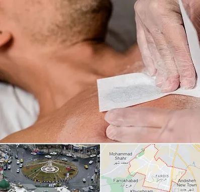 اپیلاسیون آقایان در فردیس کرج 