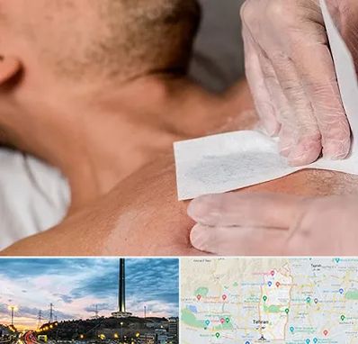 اپیلاسیون آقایان در منطقه 2 تهران 